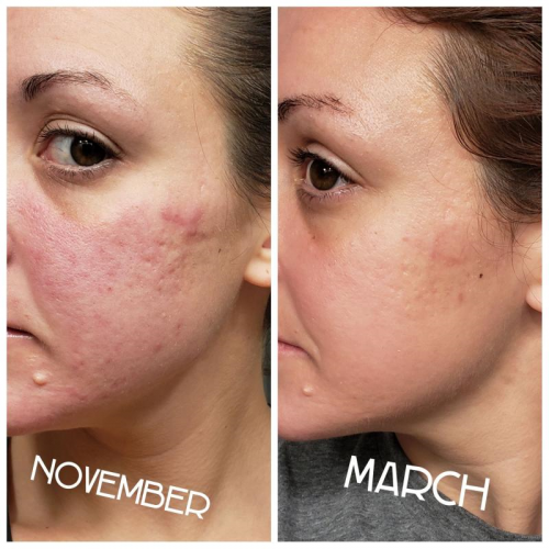 Rosehip Oil ORGANIC Cold Pressed Soap Oils & Herbs